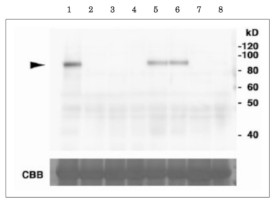 MEB1 | Membrane protein of ER body 1 in the group Antibodies Plant/Algal / Membrane Transport System / Endomembrane system at Agrisera AB (Antibodies for research) (AS20 4423)